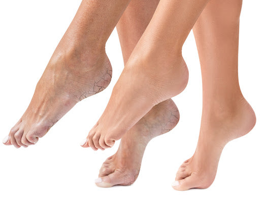 pieds secs
