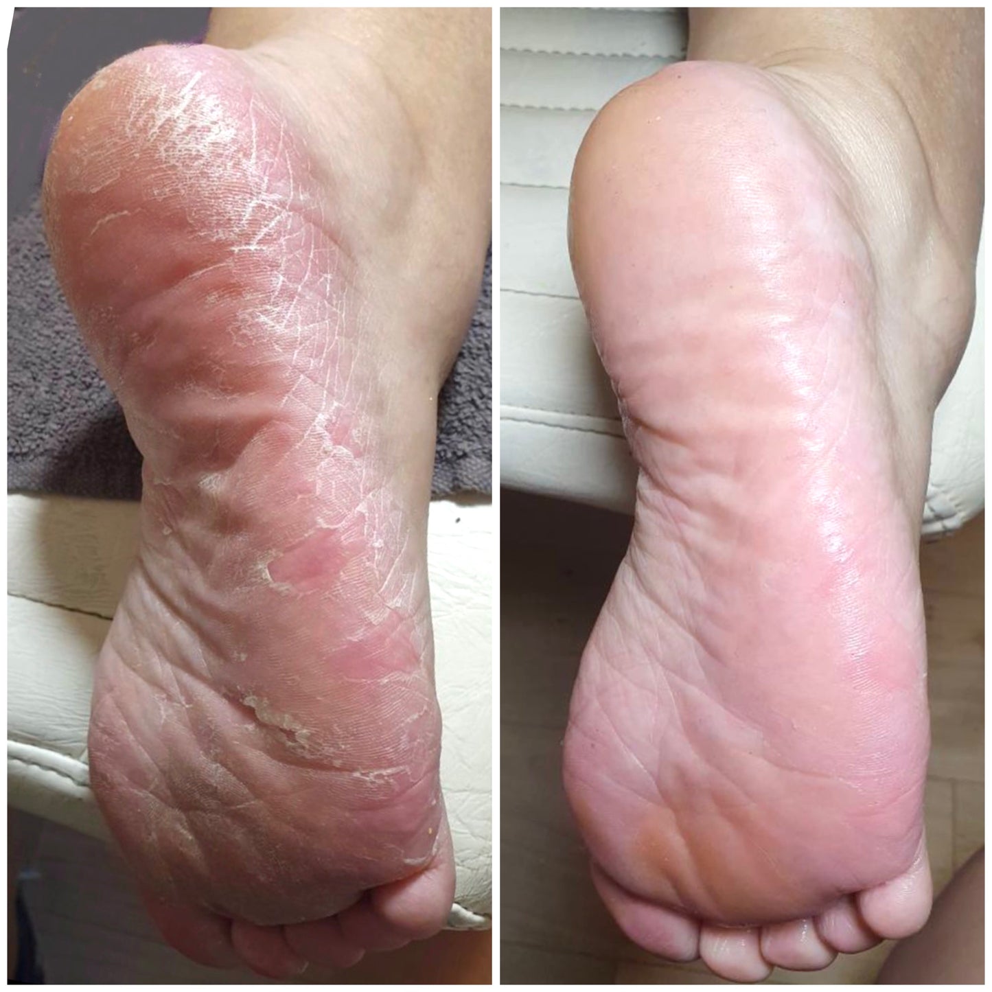 LOVASKIN INSTANT FOOT PEEL Recharge 250 ml