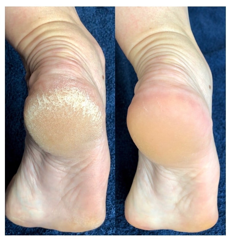 LOVASKIN INSTANT FOOT PEELING Kit Découverte - Plus de 10 soins de beauté pédicure