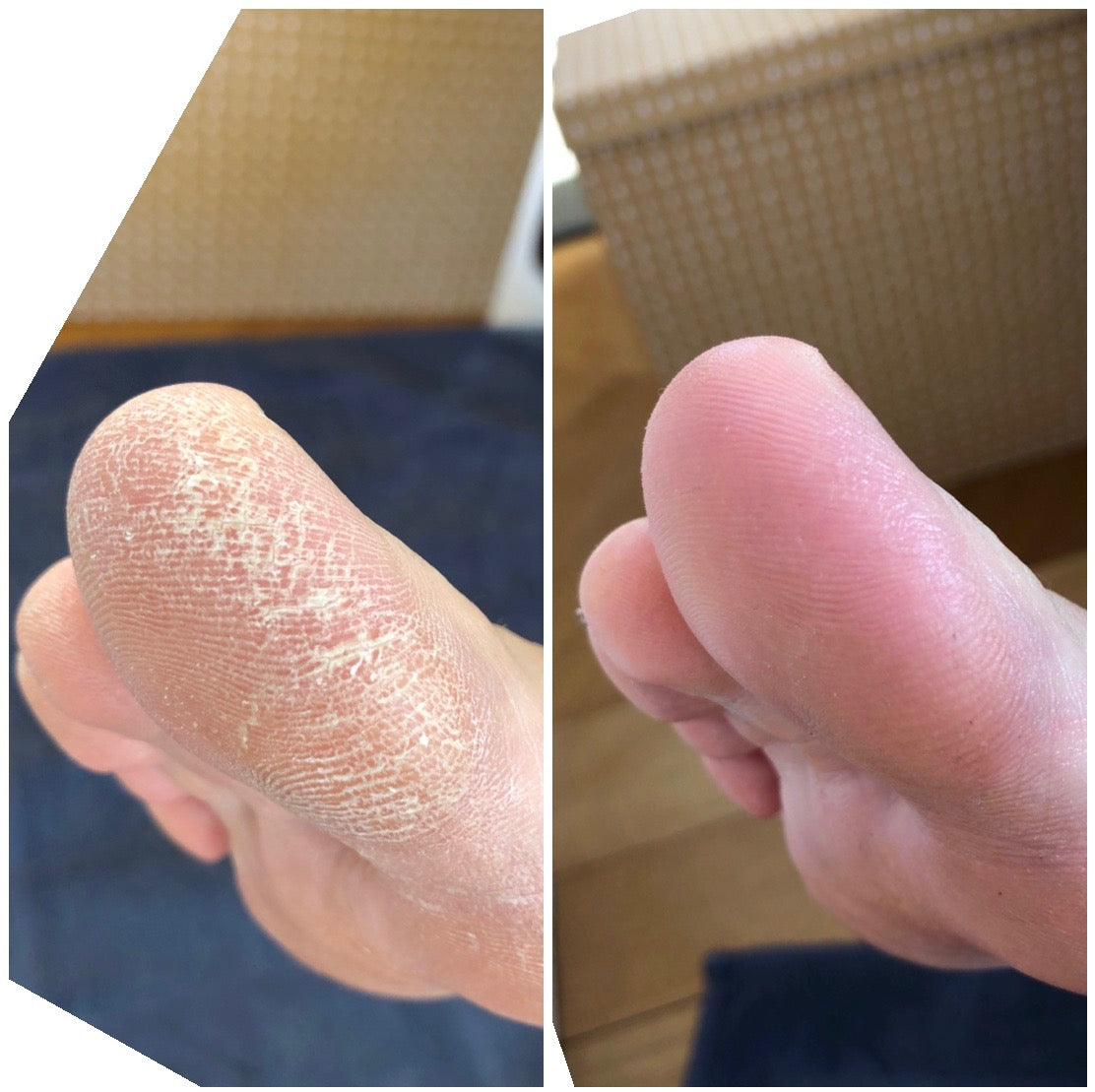 LOVASKIN INSTANT VOET PEELING XL