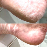 LOVASKIN INSTANT FOOT PEEL Spray bottle 2.5 fl oz - 25 uses or under 2.50 $ to have beautiful feet